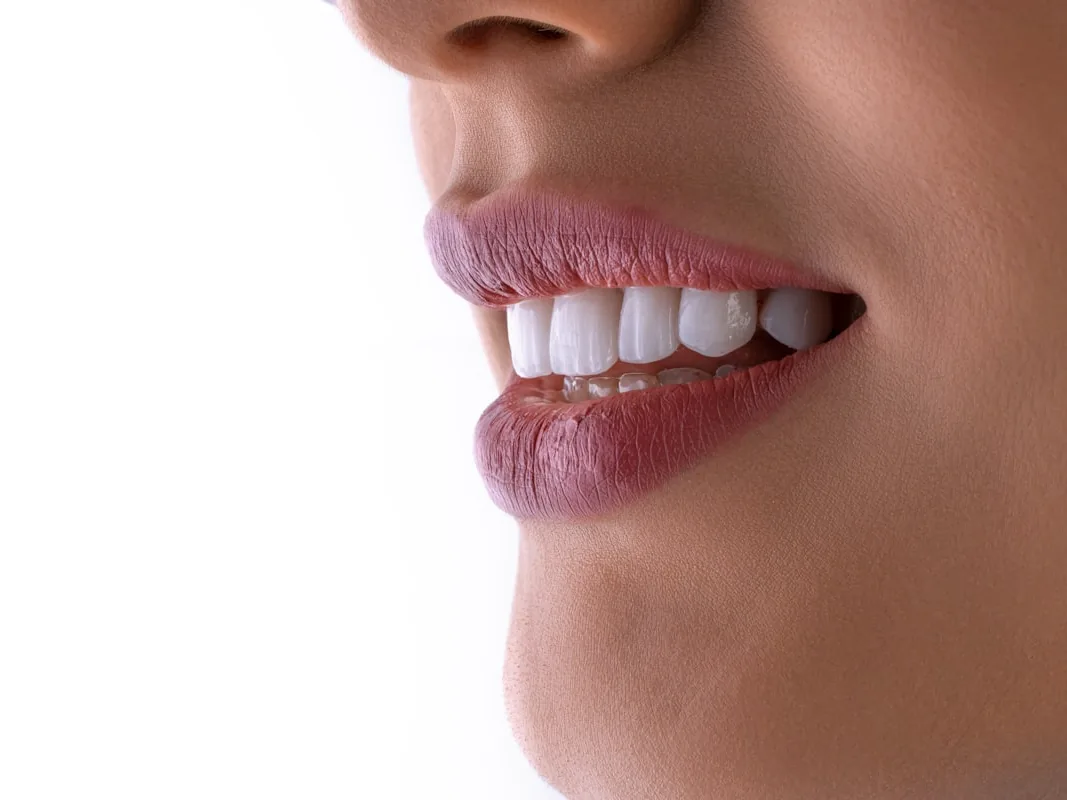 Close-up of a bright, white smile after cosmetic dental work